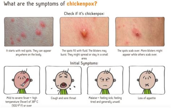 What do chicken pox look like when they first come out?