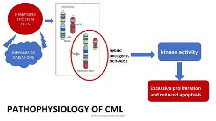 What is the most common cytogenetic abnormality detected in CLL?